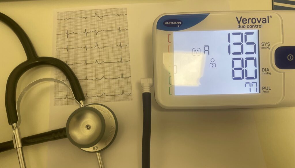 Extrasistolia Ventricular (EV) en Deportistas