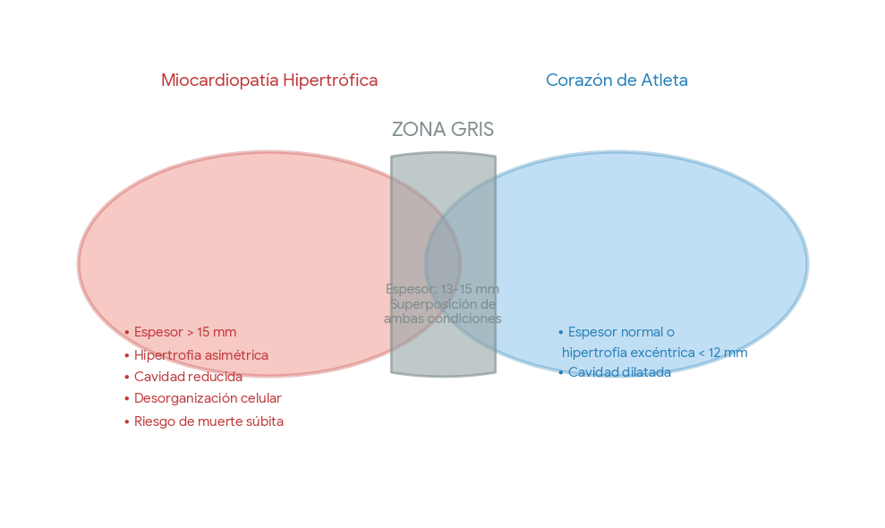 Miocardiopatía Hipertrófica vs Corazón de Atleta